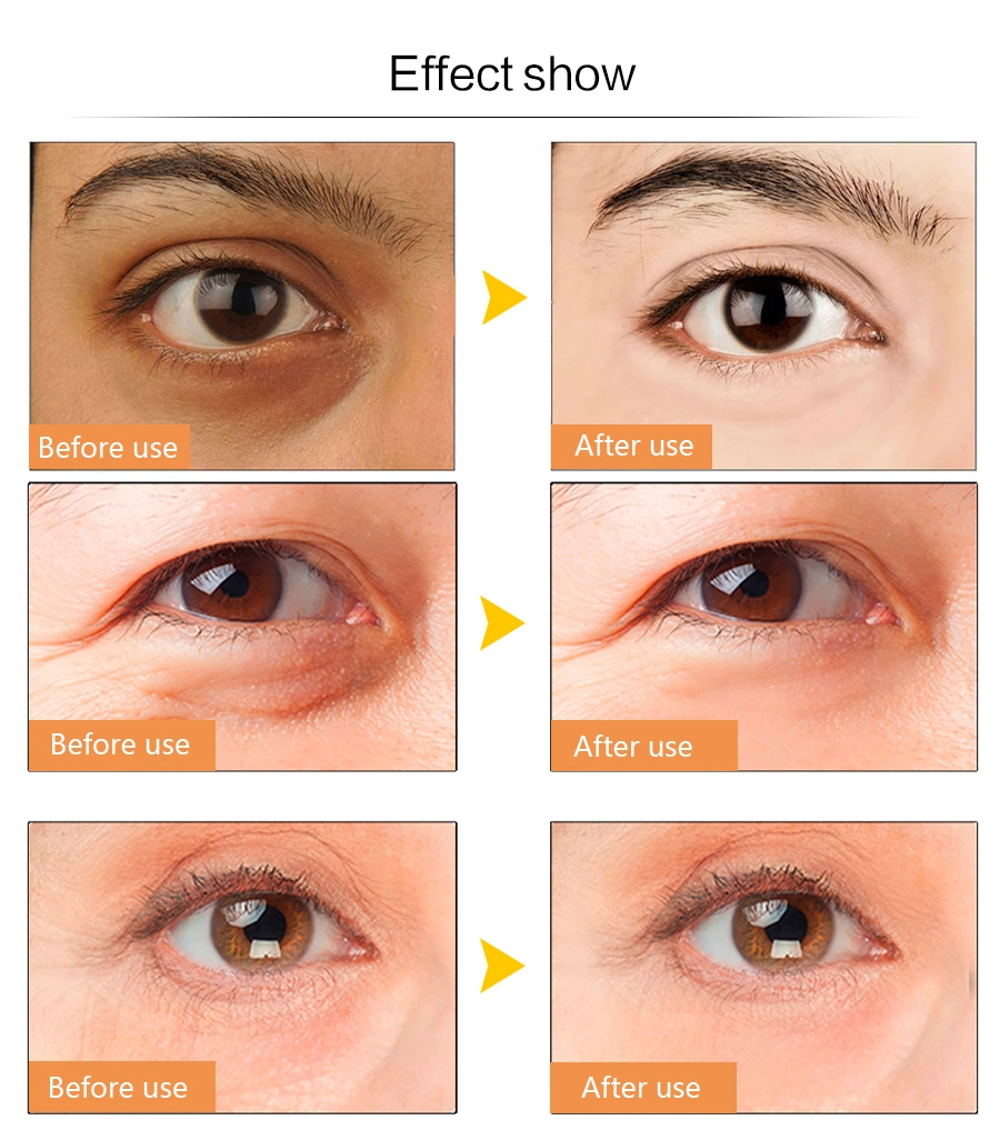 Eye Cream Anti Wrinkle Remove Dark Circles Eye Bags Repair Under Eye Cream Face Cream Eyes Serum