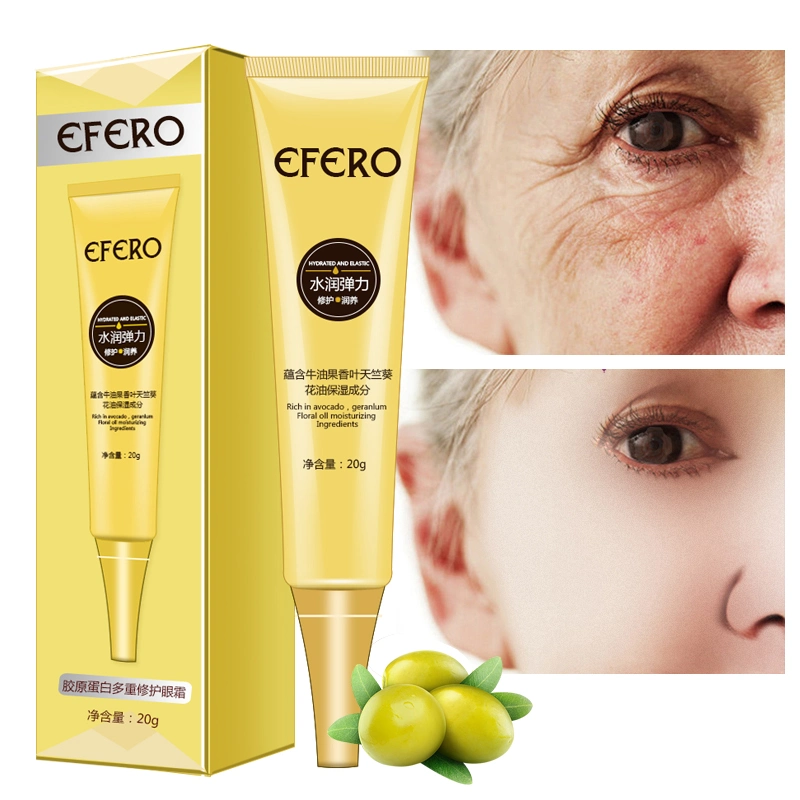 Anti-Aging Eye Cream Remove Dark Circles Anti-Puffiness Eye Cream Removal Cream Skin Care Under Eye Bags with Whey