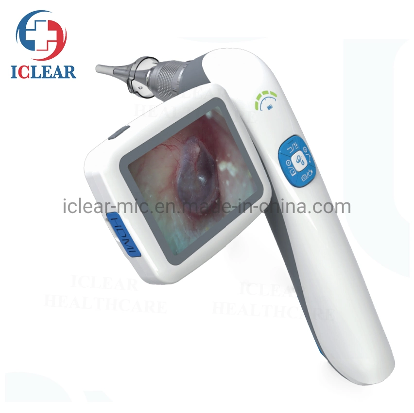 Portable HD Digital Video Ent Endoscope for Otoscope/Sinuscope/Laryngoscope