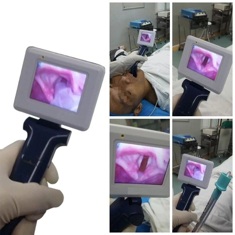 Ce/ISO Approved Medical Anesthesia Video Laryngoscope