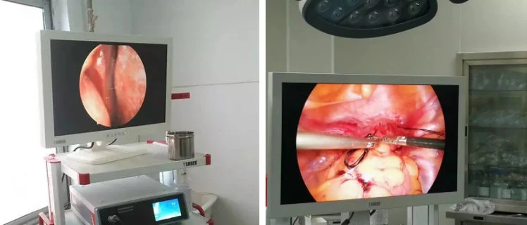 Arthroscopy Endoscopy Camera System Complete Endoscopy Set for Arthroscopic Knee Orthopedics Surgery