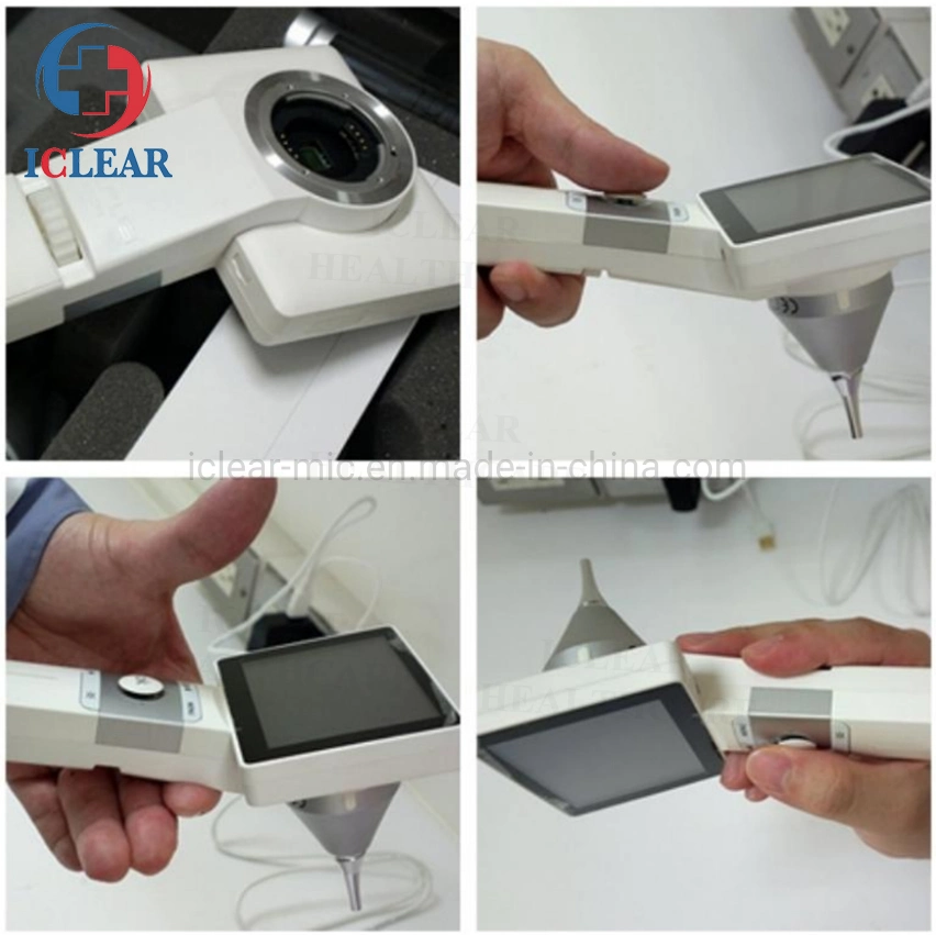WiFi HD Video Medical Endoscope for Handheld Otoscope Laryngoscope Dermatology Fundus Camera