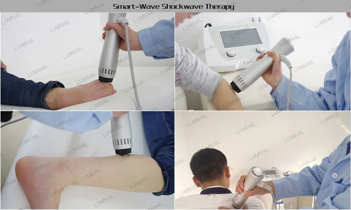 Carpal Tunnel Syndrome Shockwave Machine