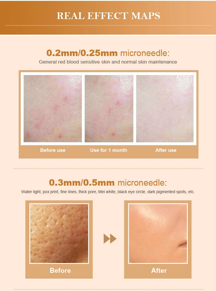 New  Arrival  Injectable  24K  Gold  Needle  Korea  Micro  Needle  Hydra  Needle