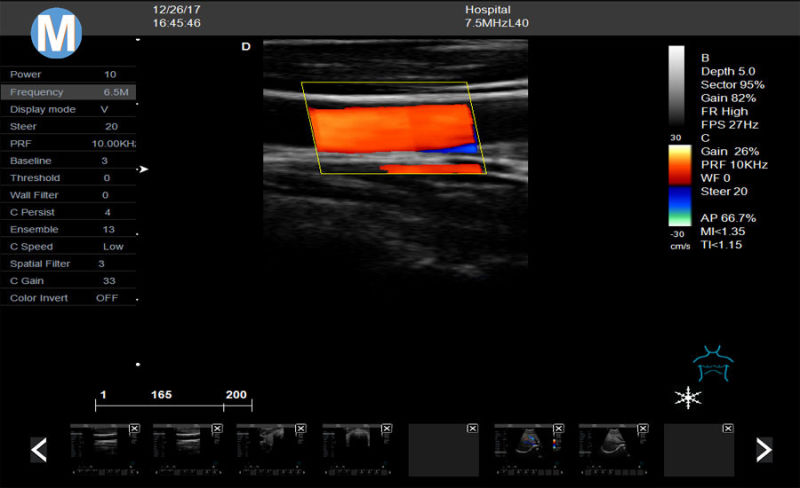Full-Digital Tissue Harmonic Imaging&#160; (THI) 4D Color Doppler Ultrasound Scanner