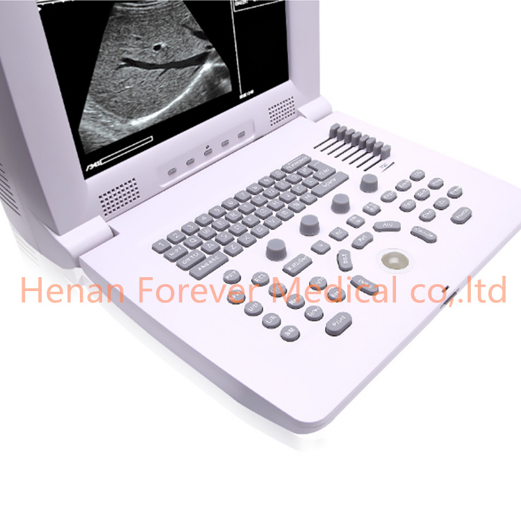 Hot Selling B/W Digital Portable Baby Ultrasound Scanner