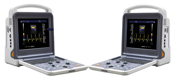 12 Inches Medical Portable Digital 3D Ultrasound Scanner