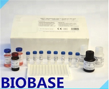 Biobase Clinical Diagnostic Elisa Kits HIV Rapid Test Kits and Reagents