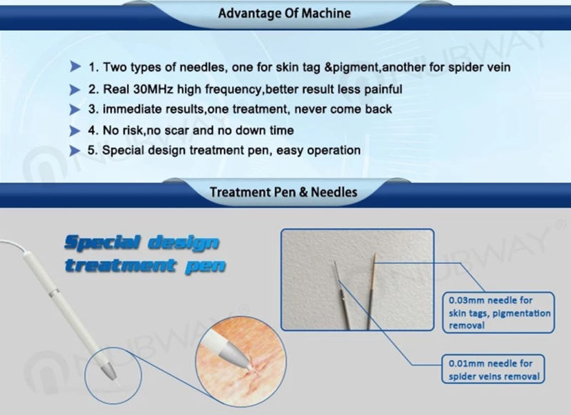 Immediately Result Spider Vein Vascular Removal Beauty Machine
