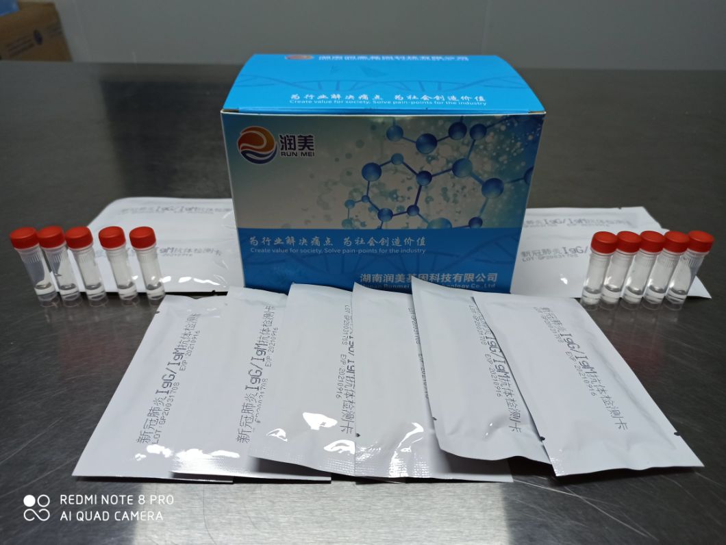 Virus Antibody Detection Medical Igg/ Igm CE FDA 2019 Ivd Testing Antibody Diagnostic Rapid Cassette Test Kit, Antigen Test Kit
