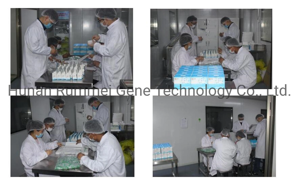 PCR Nucleic Acid Extraction Kit Fluorescent Rna Virus Test Method