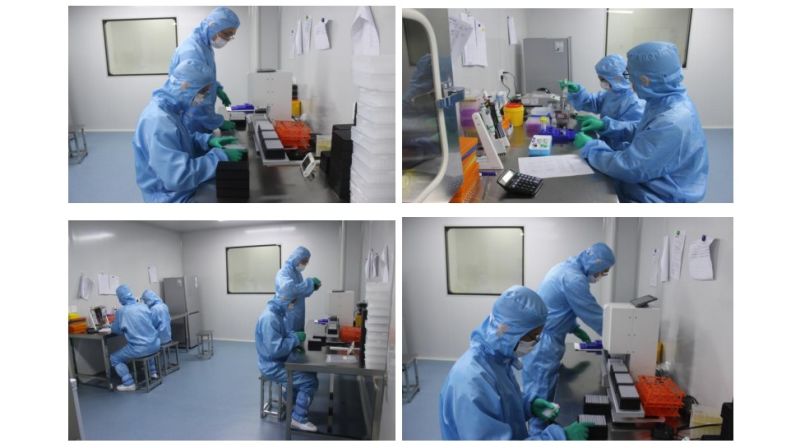 Runmei Diagnostic Kit Rapid Antibody Test for Igg Igm