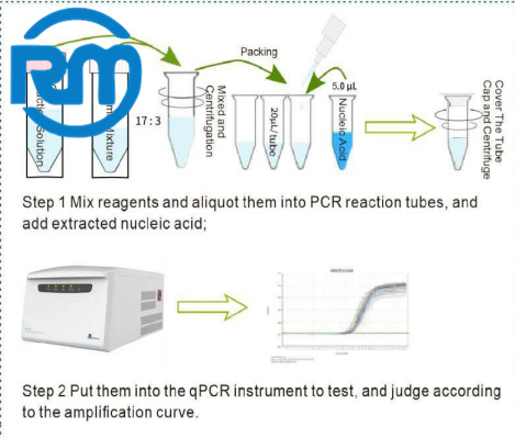 Nucleic Acid Detection Kit Diagnostic Pathological