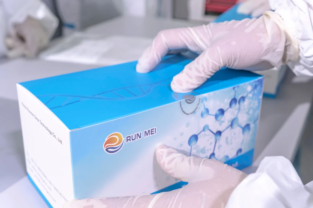 Igg Igm Rapid Test Kits Antibody Test with PCR Test Kit