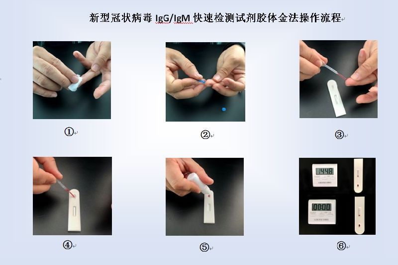 Igm/Igg Antibody Rapid Test Kit, Igm Gg Antibodycassette