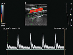 China Digital Diagnostic Instrument Color Doppler Ultrasound Scanner