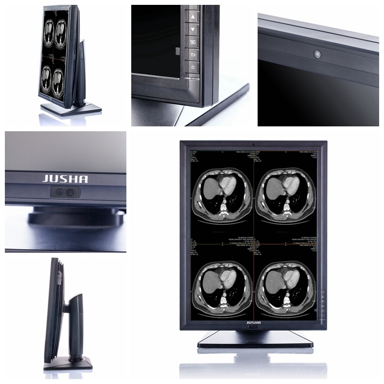 Ce Approved Diagnostic LCD Monitor for X Ray Medical Equipment