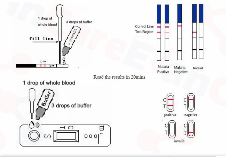 Test Malaria Malaria Test Infection Disease Diagnosis PV PF Test Kit for Malaria