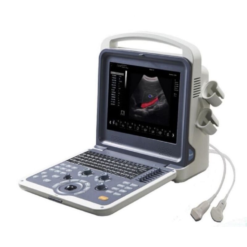 4D Color Doppler Ultrasound Diagnosis System Ultrasound Diagnostic System