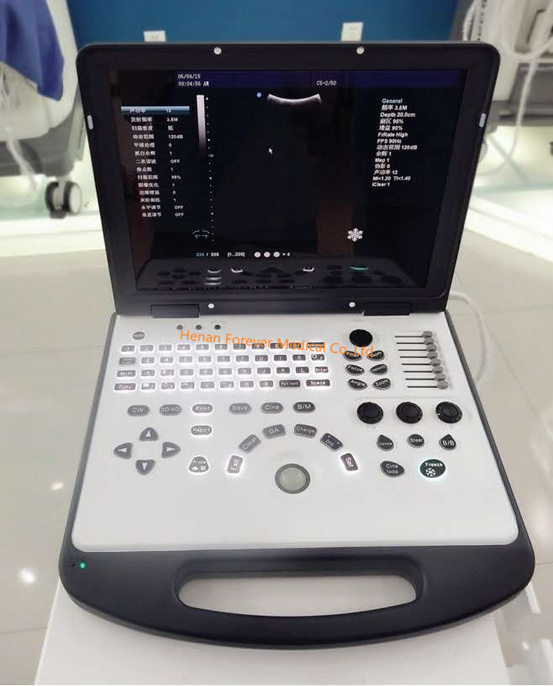 Laptop Diagnostic Ultrasound Scanner for Pregnancy Ultrasound Scan