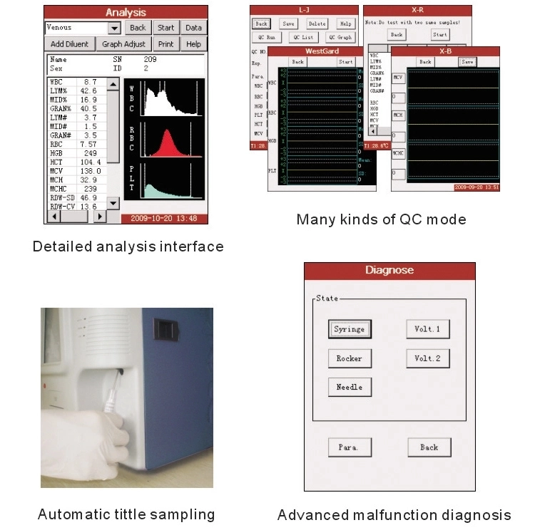 60 Test/Hour 3 Part Differential Blood Cell Counter Intelligent Cbc Test Machine Auto Hematology Analyzer