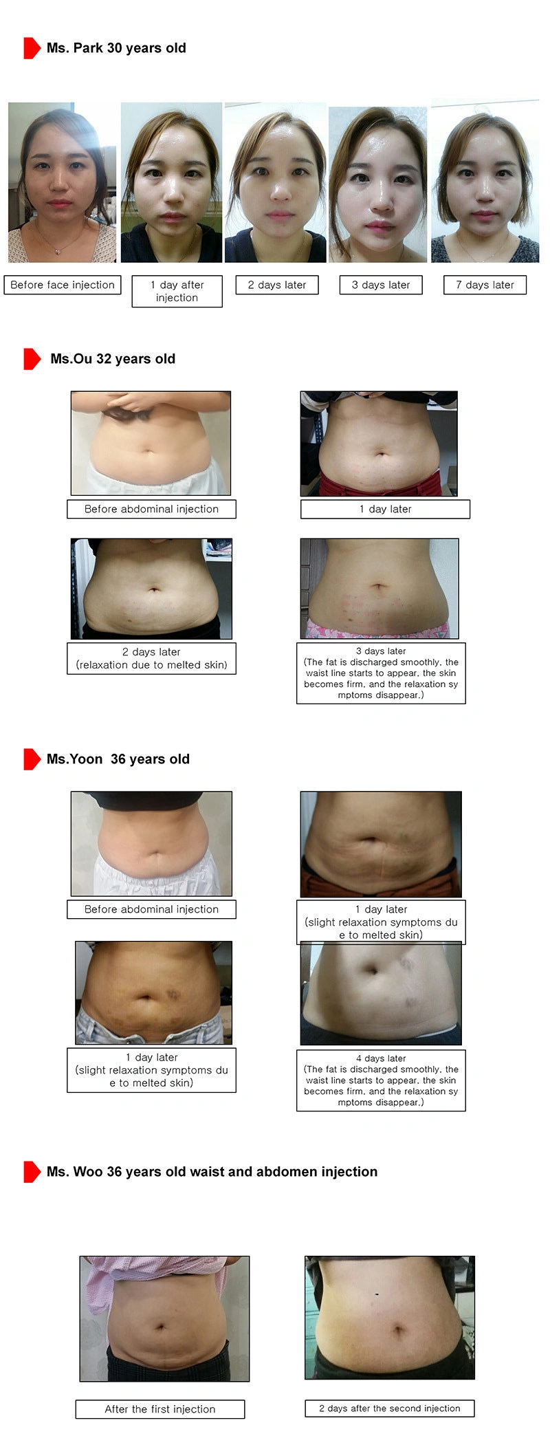 Korea Ppc Slimming Solution Lipolysis Injection for Melting Subcutaneous Fat