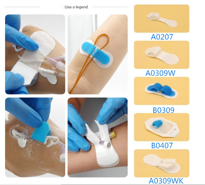 Efficient Type Hospital Medical Catheter Device for Indwelling Needle Fixation