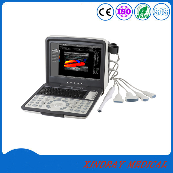 Medical Equipment Clinic Portable Cardio Echo Doppler Ultrasound Scanner