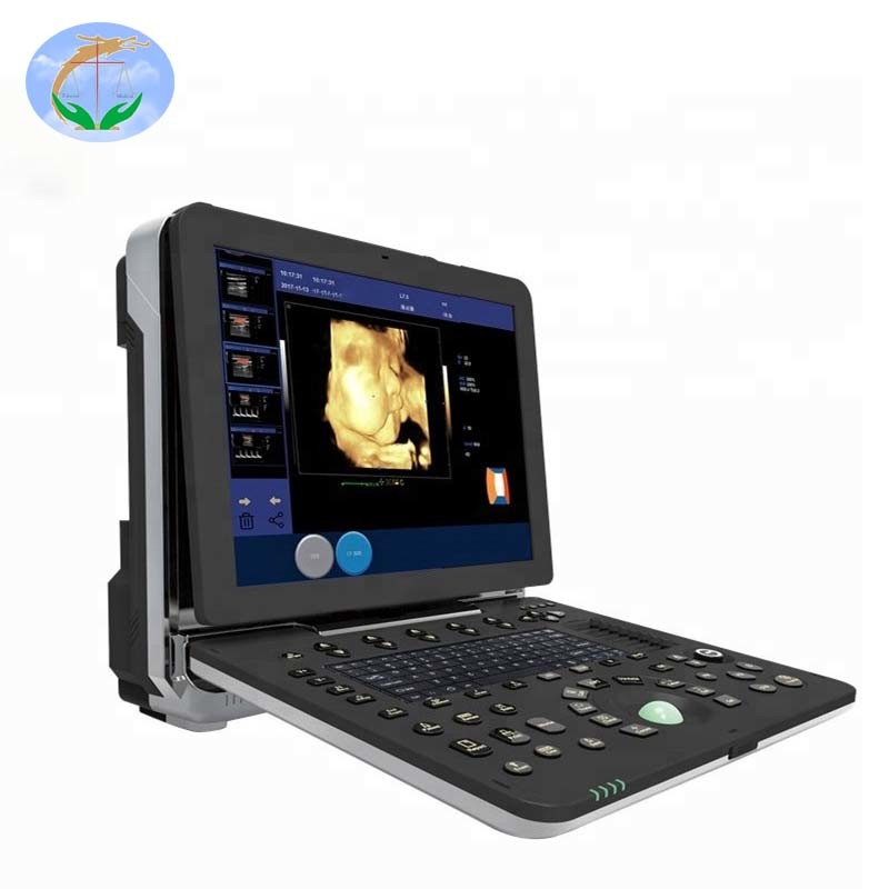 Hospital Medical Equipment Portable 3D 4D Digital Color Doppler Ultrasound Scanner