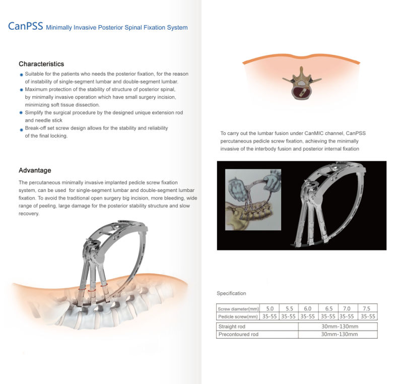 Surgical Instruments Minimally Invasive Pedicle Screw Instruments, Percutaneous Screw, Posterior Spinal Fixation Instruments