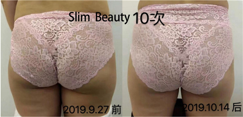 Portable Hiemt Muscle Machine for Body Slimming Buttocks Lifting