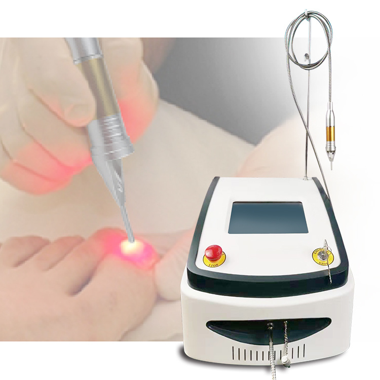 Top Sale 980nm Diode Laser Onychomycosis Toe Nail Fungus Treatment Podiatry Instruments Podiatry Instruments