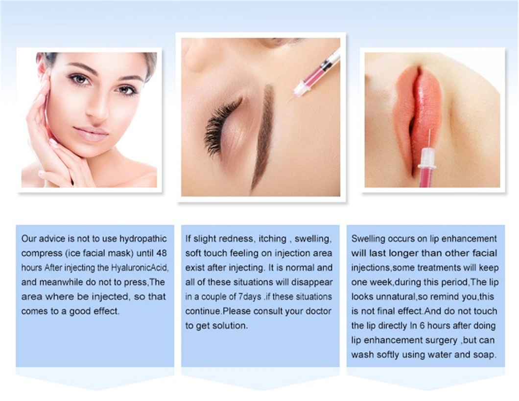 Hyaluronic Acid Injections to Buy Deep 2ml Hyaluronate Acid Dermal Filler for Face to Remove Wrinkles