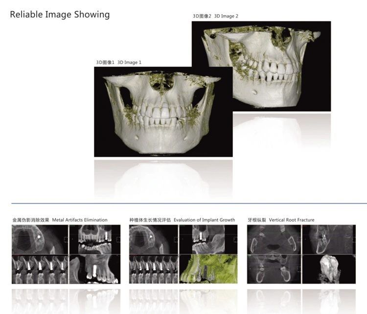 My-D065 Medical Tomography Cbct Dental X Ray Digital Panoramic X-ray Equipment