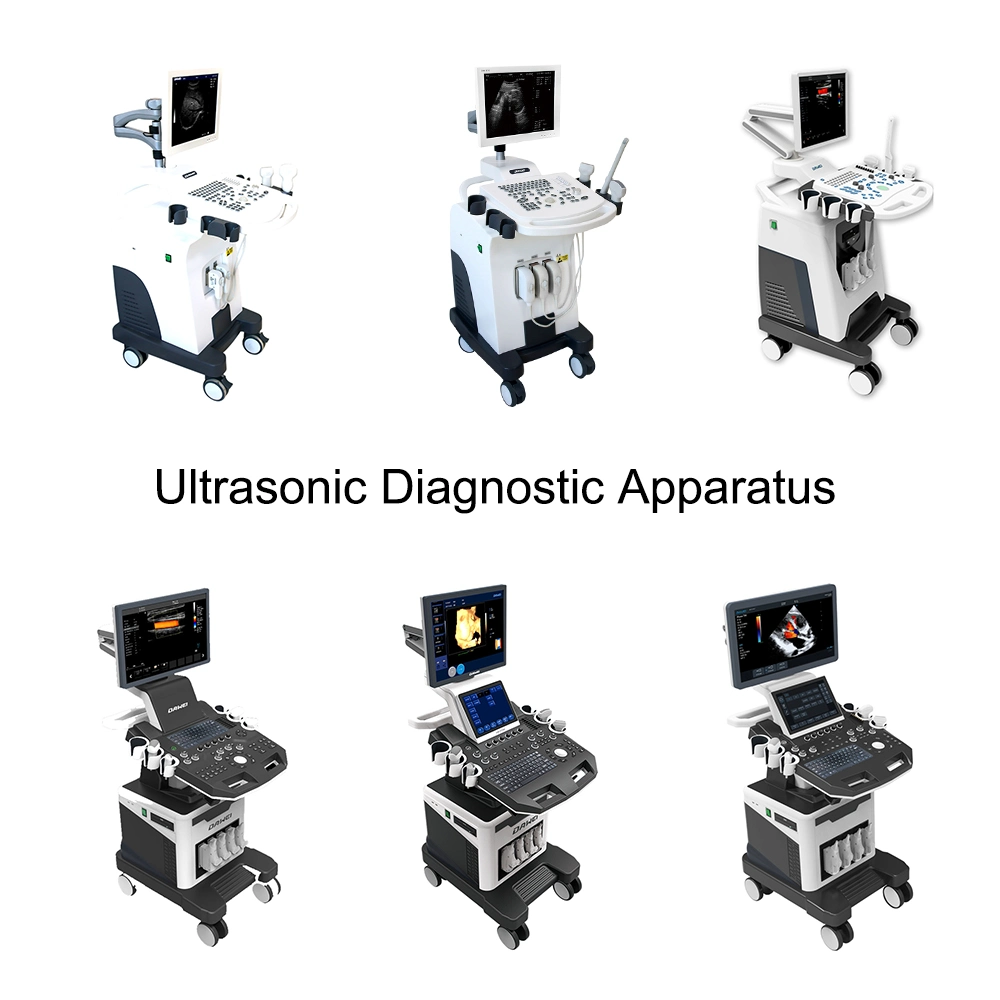China Top Cardiac Ultrasound Machine Trolley Color Doppler Ultrasound Scanner