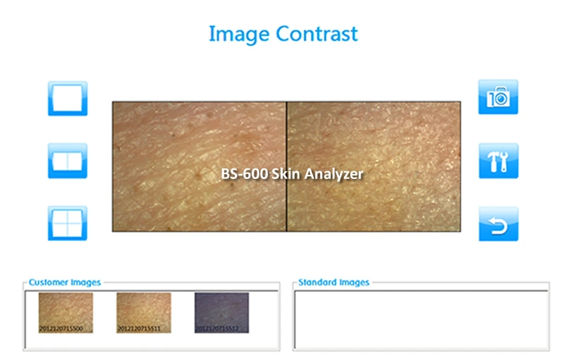 Handheld Skin and Hair Analysis Analyzer Machine Skin Analysis System