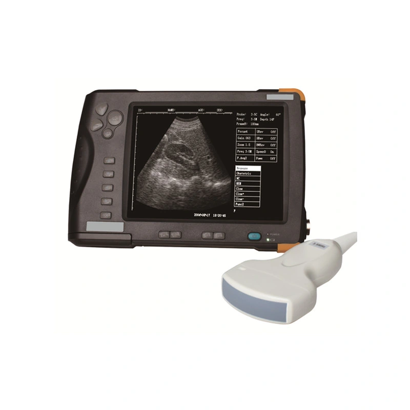 China High Quality Mini Veterinary Ultrasound to Cattle, Portable Pig Pregnancy Ultrasound Scanner Price
