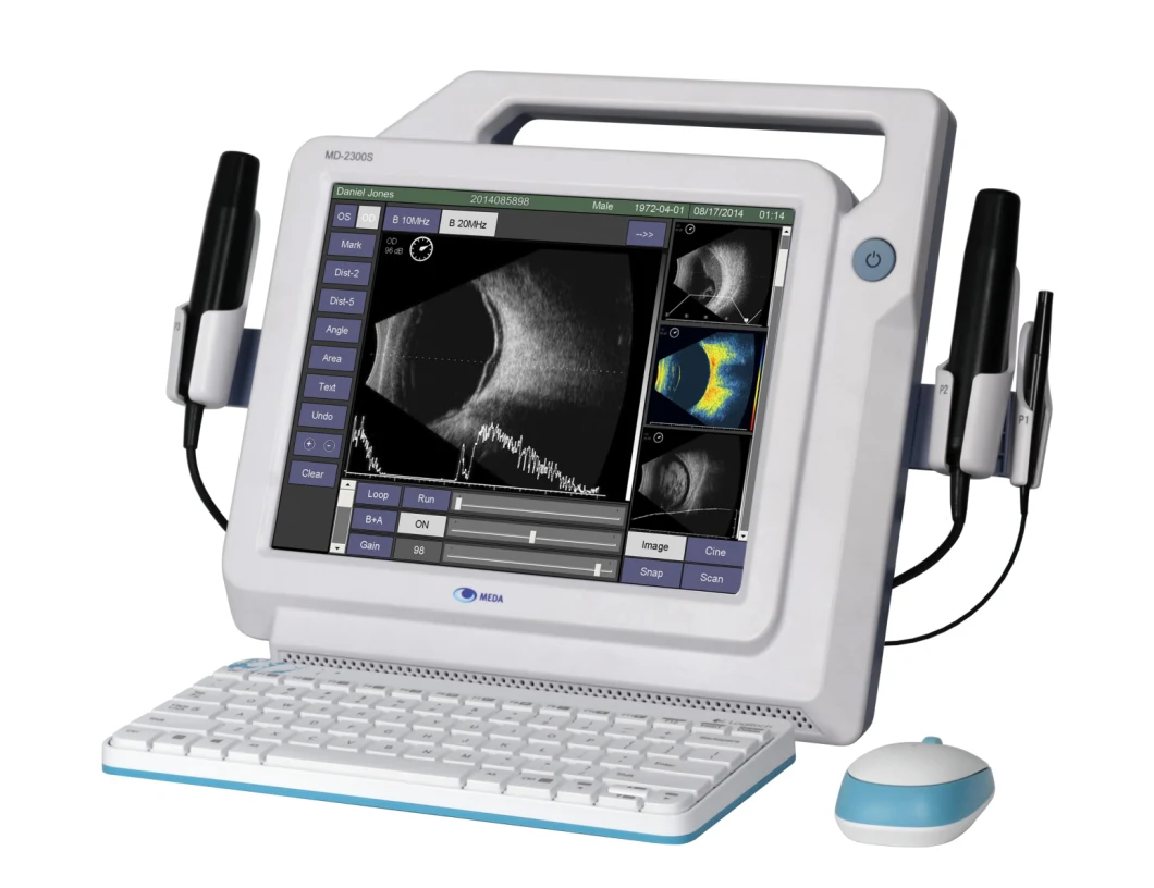 Portable B Scan Ultrasound a/B Scanner for Ophthalmology with Color Touch Screen (MD-2300S)