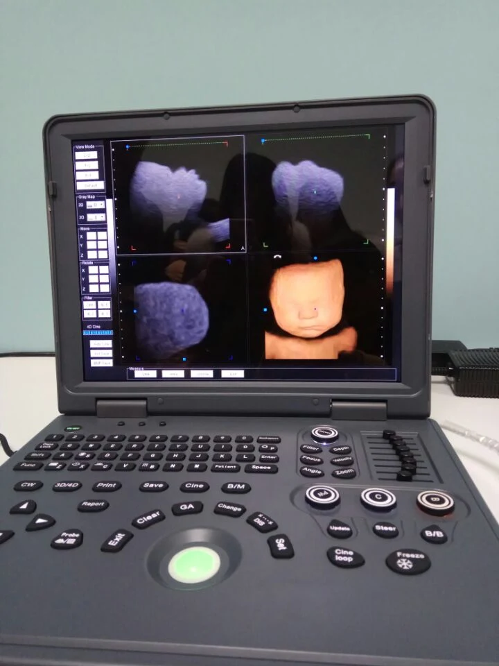 Cheap Portable Color Doppler Ultrasound Machine Diagnostic System Anesthesia Cardiac Ultrasound