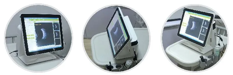 China Factory Supplier Ophthalmic Equipment Ab Ophthalmic Scan