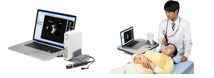 China Supplier Ophthalmic Equipment Ophthalmic Ultrasound Ab Scan