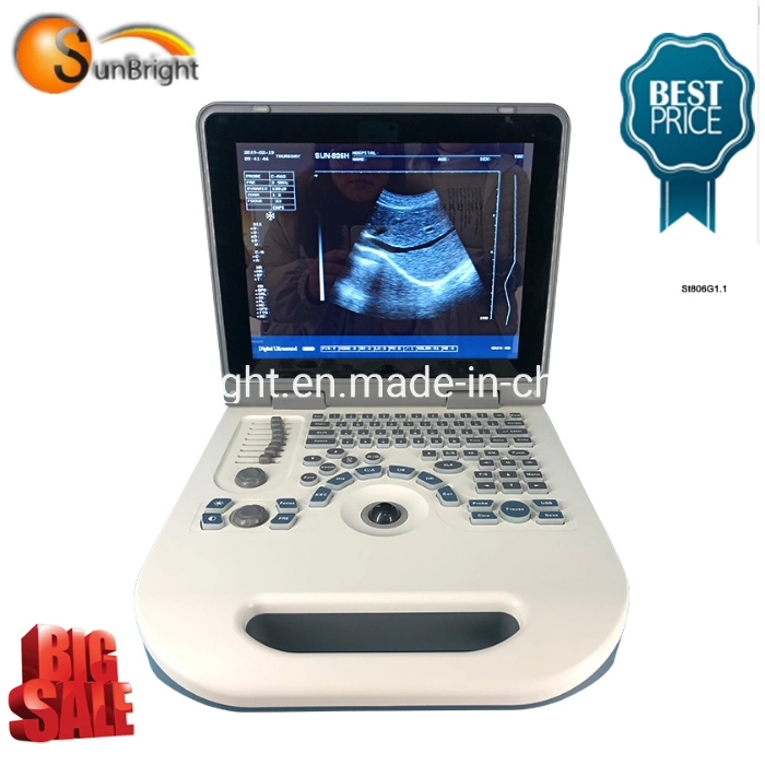 High Quality Ultrasound Competitive Price 2 Probe Ports