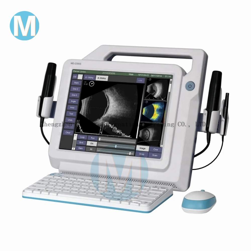 B Scan Ultrasound a/B Scan for Ophthalmology with Trolley and Printer