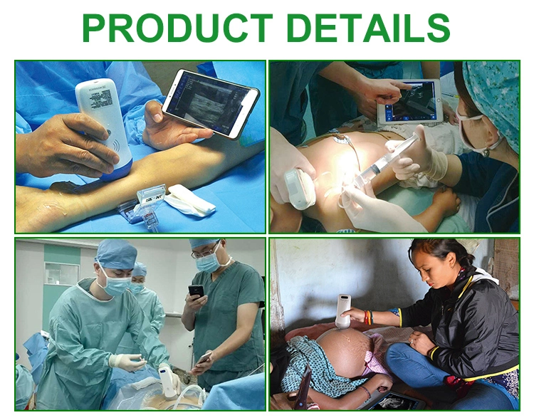 IN-a5m High quality USG adults ultrasound probe ultrasound scanner price