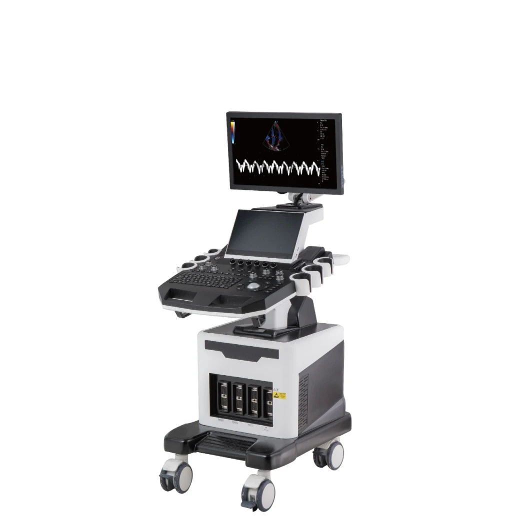 High Quality Mobile Portable 4D Trolley Color Doppler Ultrasound Scanner