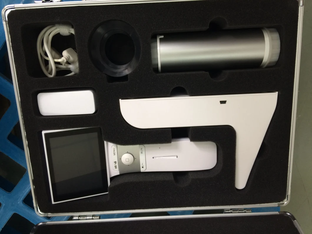 Advanced Portable Medical Camera for Fundus Imaging, Diasgosis From Msl (MSLHA03)