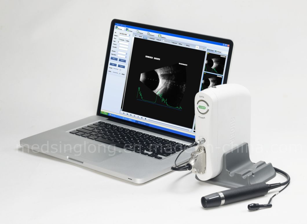 Medical Ultrasonic a/B Scan Portable Ophthalmic Equipment a/B Scan for Sale Mslyz09