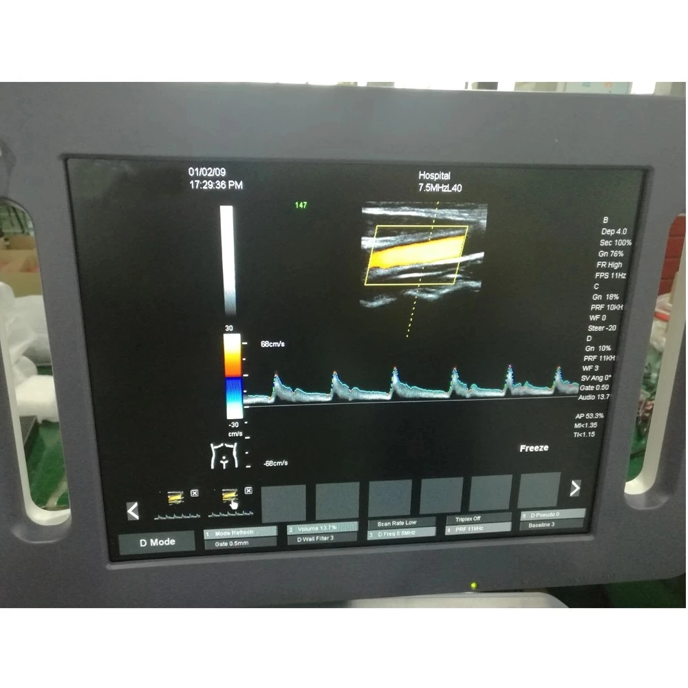 Hot Sale Smart Diagnostic Ultrasound Trolley Ultrasound Machine