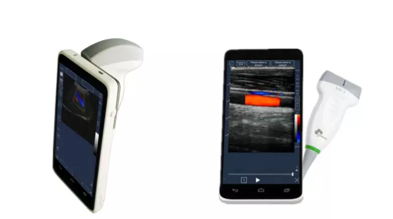 128 Elements High Quality Image Wireless Ultrasound Probe / Android& iPad Ultrasound Scanner / Wireless Ultrasound Machine Price