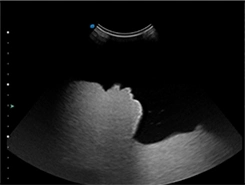 China Top Cardiac Ultrasound Machine Trolley Color Doppler Ultrasound Scanner